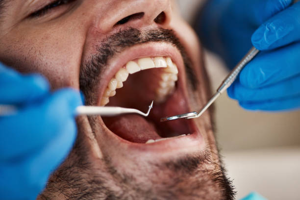 Best Emergency Root Canal Treatment in Mcdonough, GA